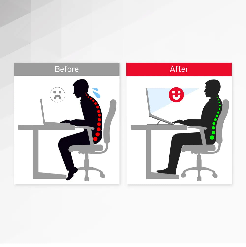 Unitek OT155SL Mechanical Foldable Laptop Stand - للتقنيات الحديثة TT TAB متجر